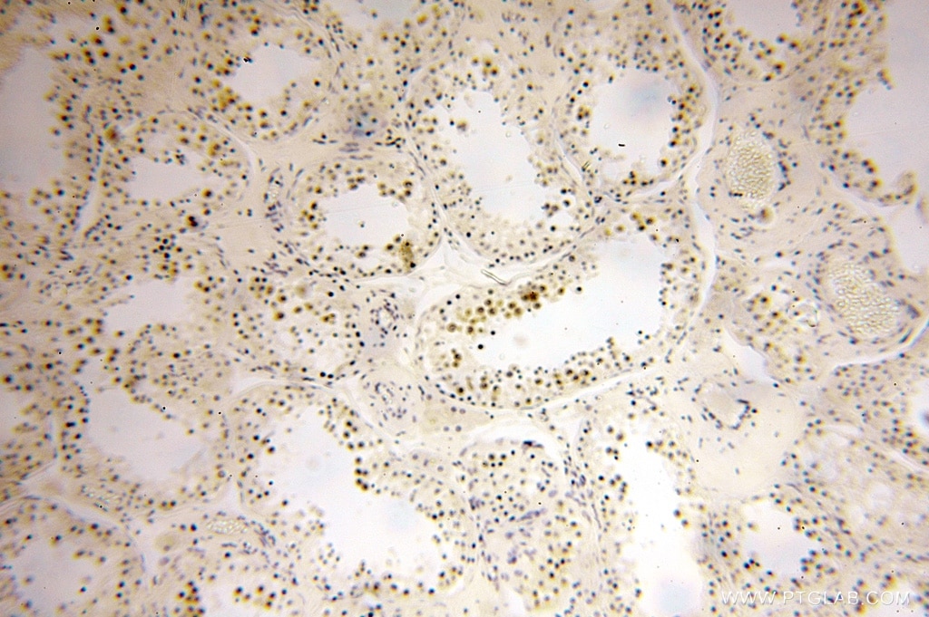 Immunohistochemistry (IHC) staining of human testis tissue using BTBD1 Polyclonal antibody (15859-1-AP)