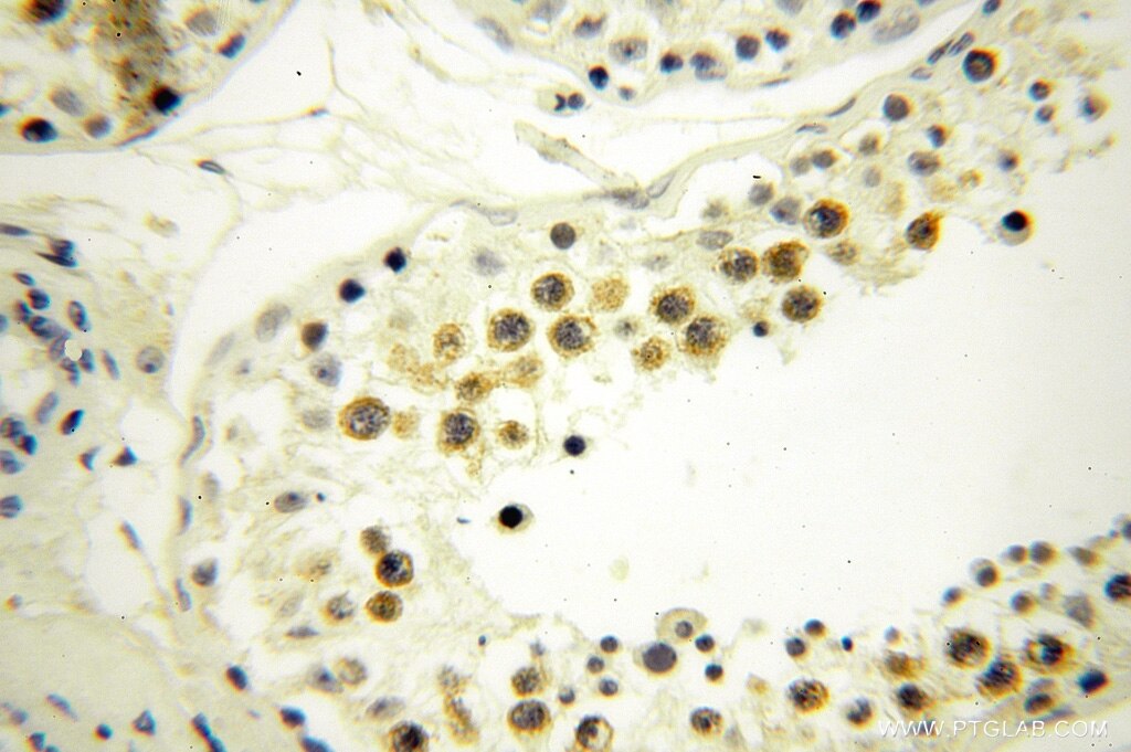 Immunohistochemistry (IHC) staining of human testis tissue using BTBD1 Polyclonal antibody (15859-1-AP)