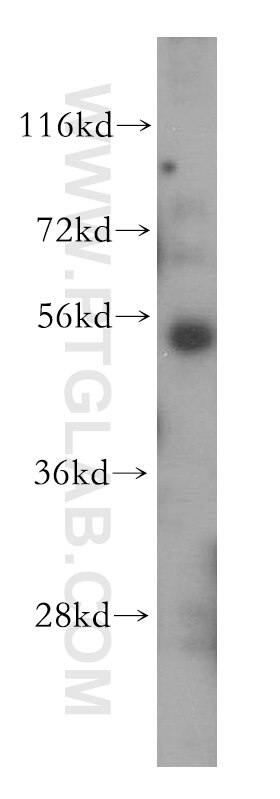 Western Blot (WB) analysis of HeLa cells using BTBD1 Polyclonal antibody (15859-1-AP)