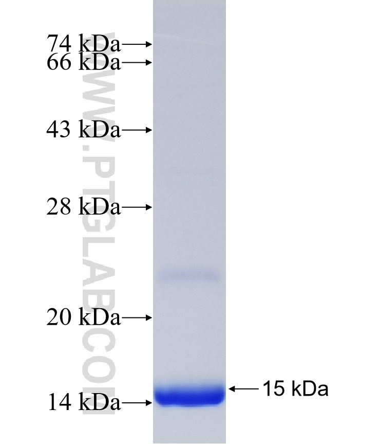 BTBD1 fusion protein Ag32400 SDS-PAGE BTBD1 fusion protein Ag32400 SDS-PAGE