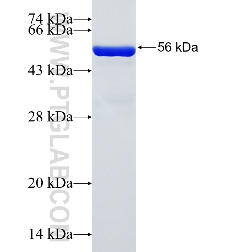 BTBD1 fusion protein Ag34663 SDS-PAGE BTBD1 fusion protein Ag34663 SDS-PAGE