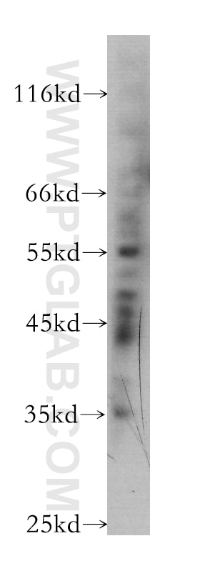 Western Blot (WB) analysis of PC-3 cells using BTBD10 Monoclonal antibody (60129-1-Ig)