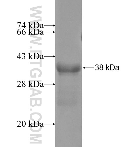 BTBD10 fusion protein Ag10667 SDS-PAGE
