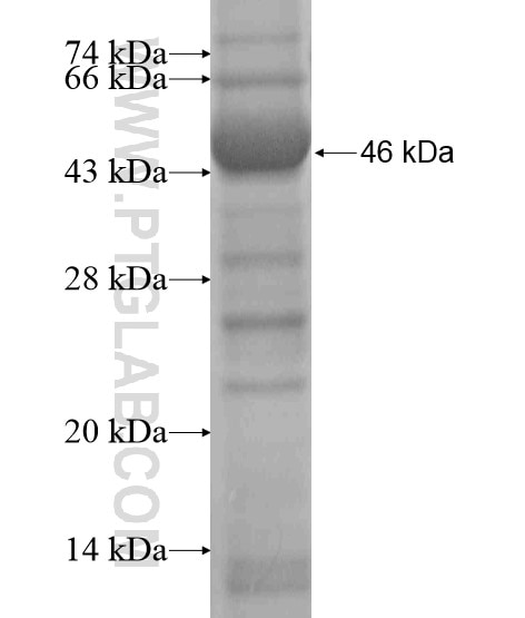 BTBD16 fusion protein Ag20672 SDS-PAGE