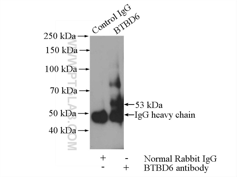 Immunoprecipitation (IP) experiment of Y79 cells using BTBD6 Polyclonal antibody (13776-1-AP)