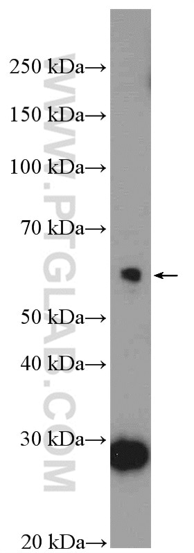 Western Blot (WB) analysis of HepG2 cells using BTBD6 Polyclonal antibody (13776-1-AP)