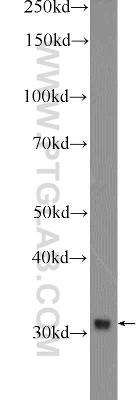 Western Blot (WB) analysis of HepG2 cells using BTBD8 Polyclonal antibody (23897-1-AP)