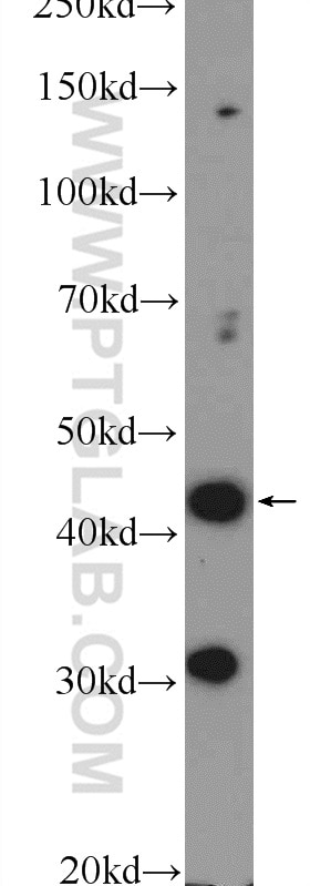 Western Blot (WB) analysis of HEK-293 cells using BTBD8 Polyclonal antibody (23897-1-AP)
