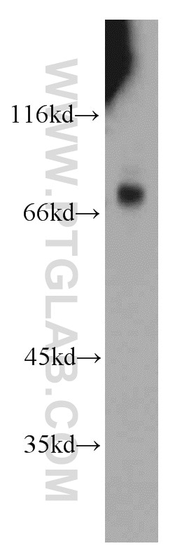 Western Blot (WB) analysis of mouse heart tissue using BTBD9 Polyclonal antibody (21882-1-AP)