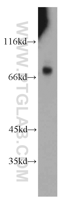 WB analysis of mouse heart using 21882-1-AP