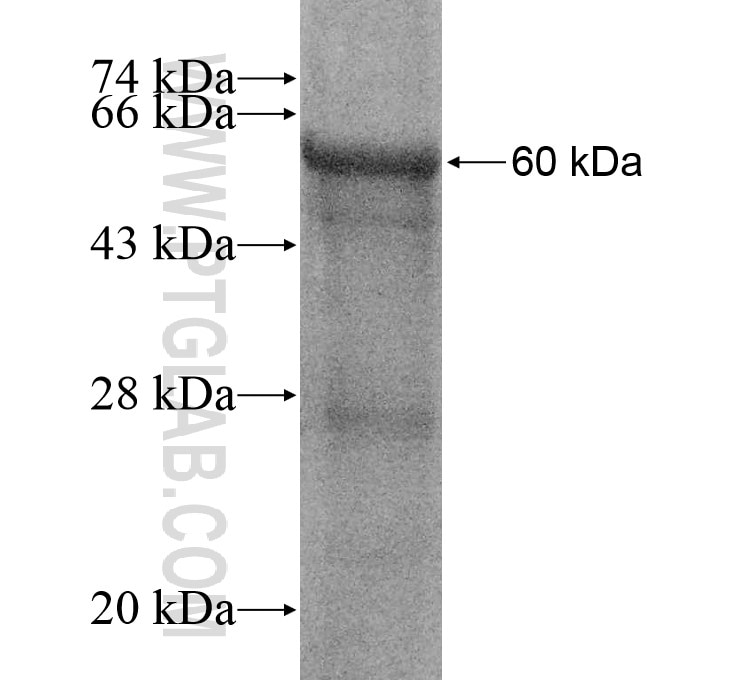 BTBD9 fusion protein Ag16423 SDS-PAGE