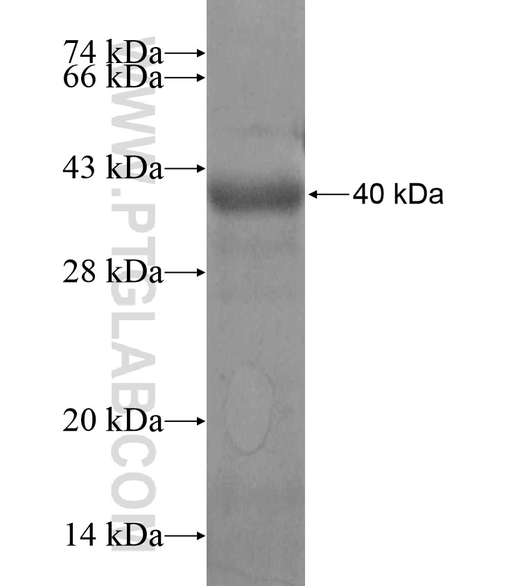 BTBD9 fusion protein Ag17256 SDS-PAGE