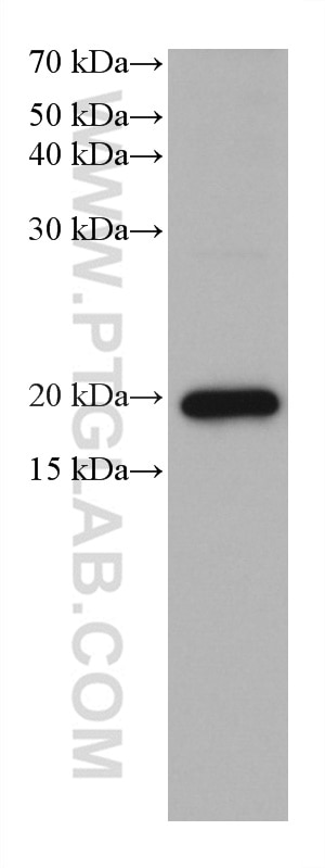 Western Blot (WB) analysis of A549 cells using BTC Monoclonal antibody (66683-1-Ig)