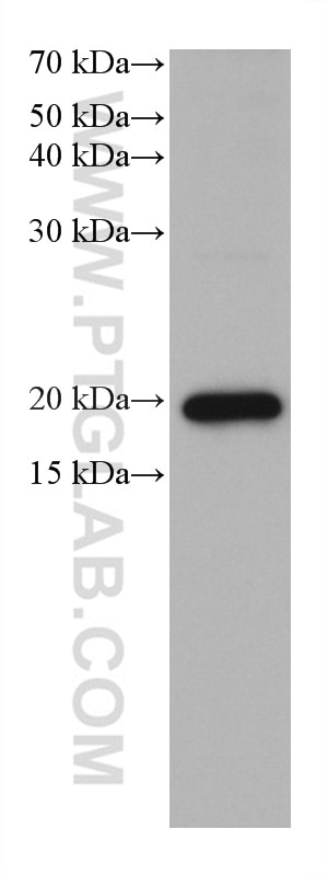 WB analysis of A549 using 66683-1-Ig
