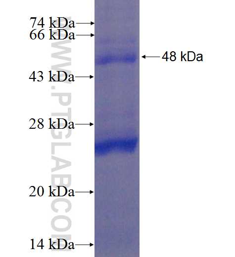 BTC fusion protein Ag22441 SDS-PAGE