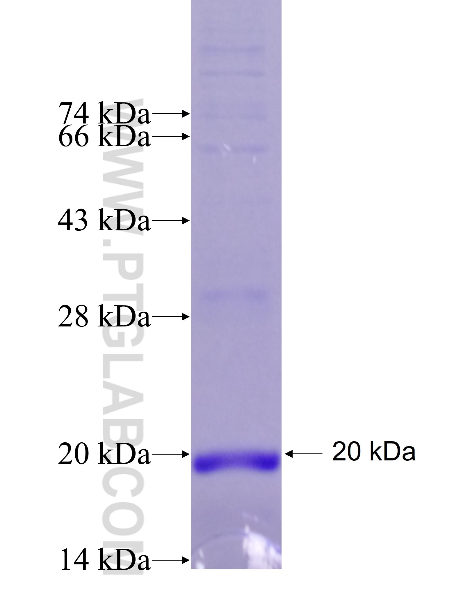 BTC fusion protein Ag26809 SDS-PAGE