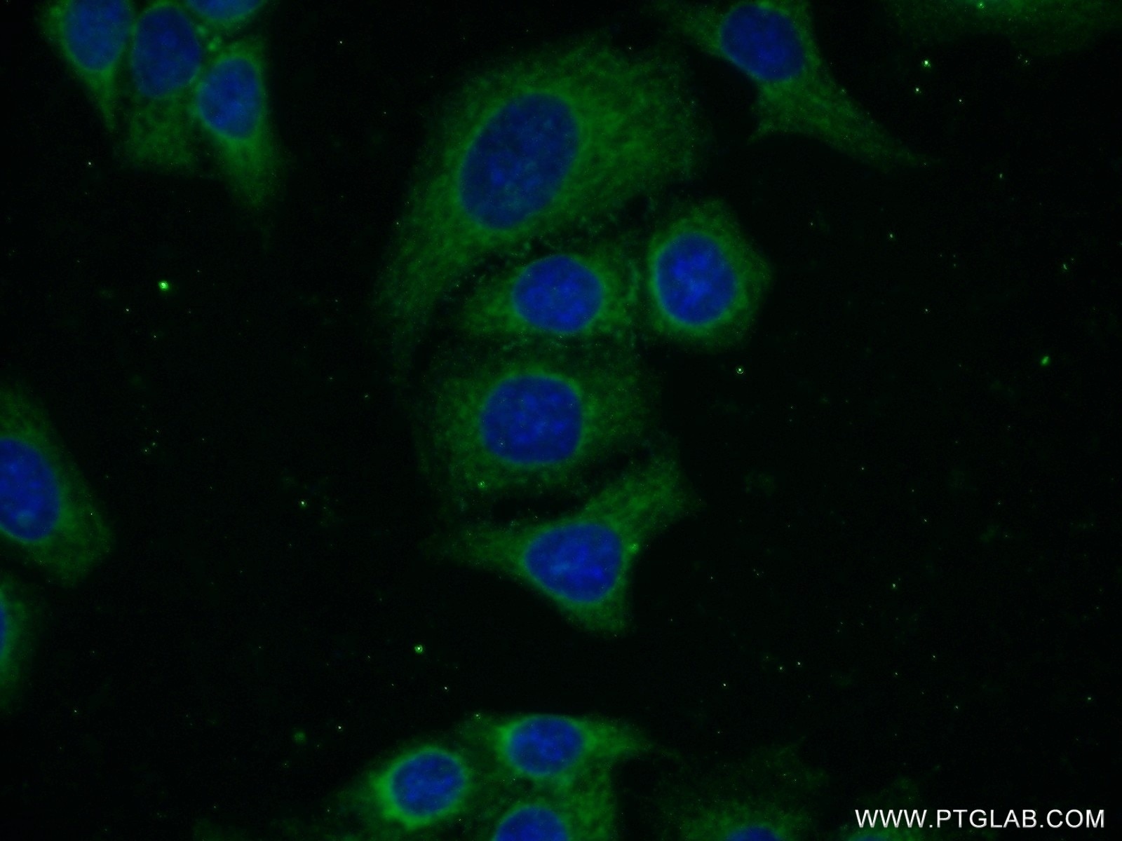 Immunofluorescence (IF) / fluorescent staining of HeLa cells using BTD Polyclonal antibody (16330-1-AP)