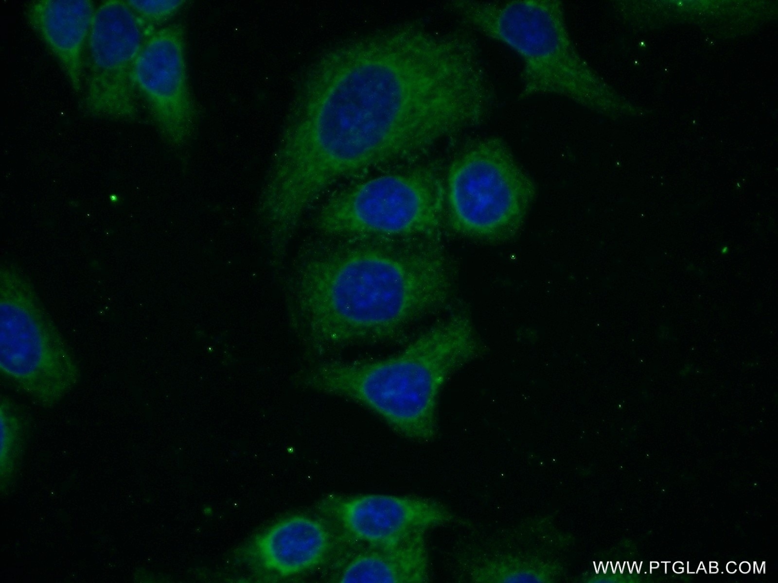 IF Staining of HeLa using 16330-1-AP