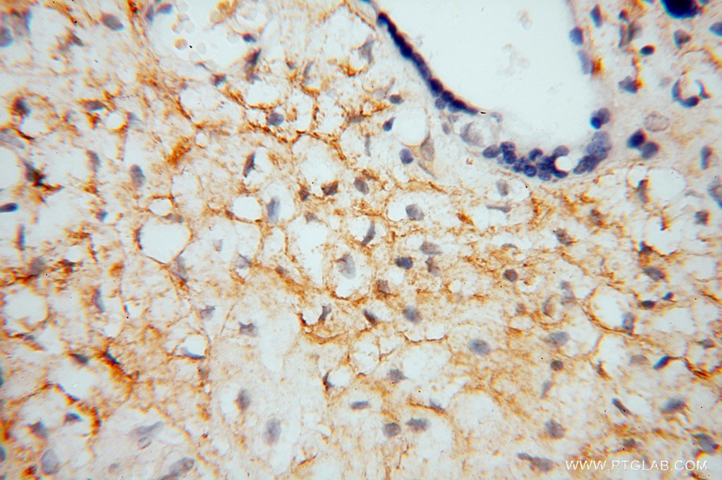 Immunohistochemistry (IHC) staining of human placenta tissue using BTD Polyclonal antibody (16330-1-AP)