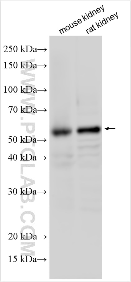 Western Blot (WB) analysis of various lysates using BTD Polyclonal antibody (16330-1-AP)