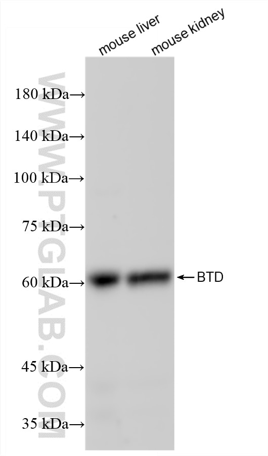 Western Blot (WB) analysis of various lysates using BTD Recombinant antibody (84613-2-RR)