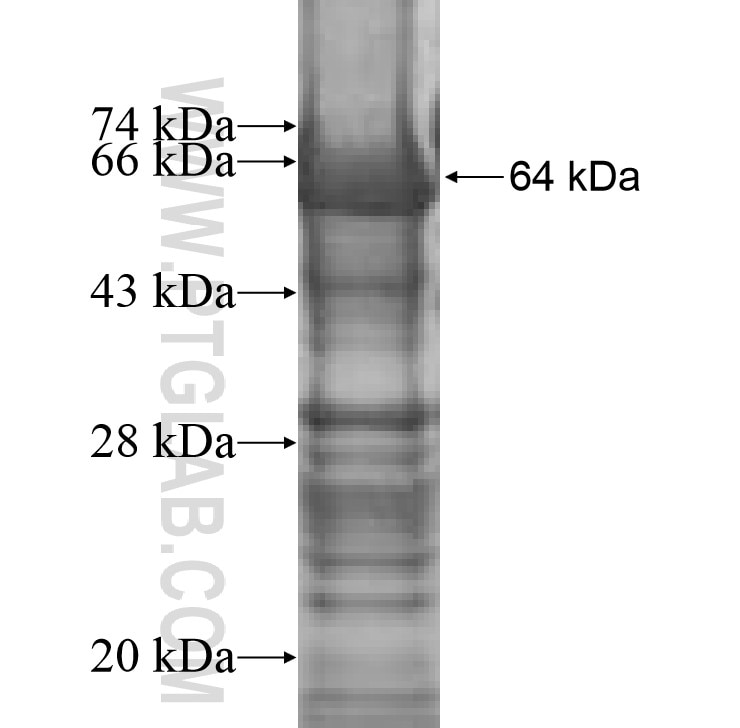 BTD fusion protein Ag9449 SDS-PAGE