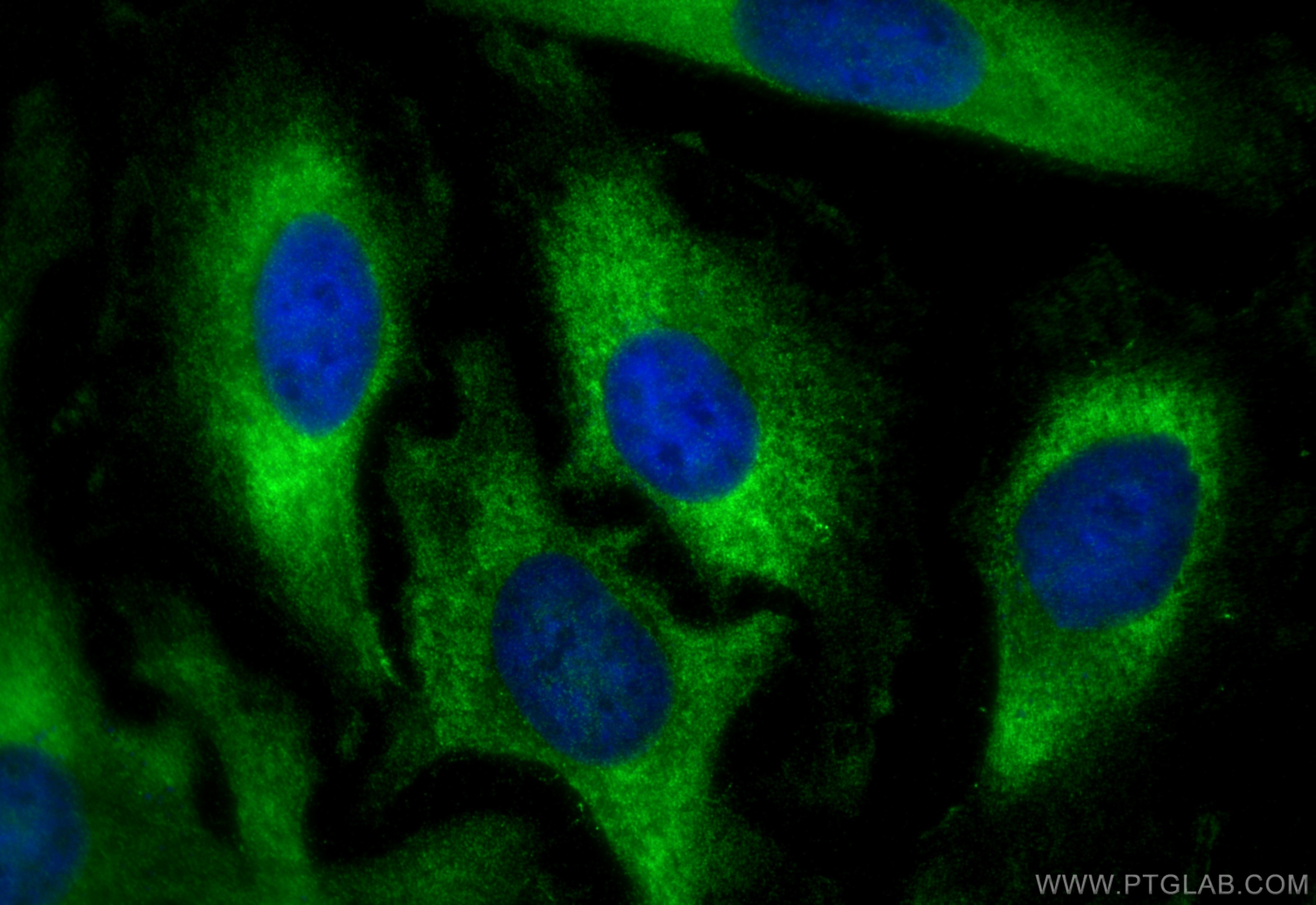 Immunofluorescence (IF) / fluorescent staining of HeLa cells using BTF3 Polyclonal antibody (15415-1-AP)