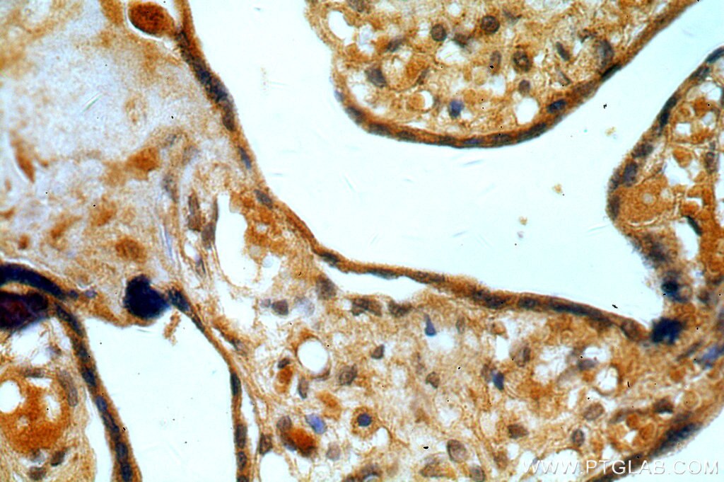 IHC staining of human placenta using 19753-1-AP