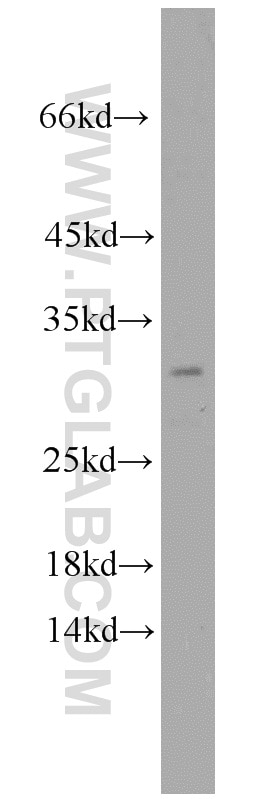 Western Blot (WB) analysis of human brain tissue using BTF3L3-Specific Polyclonal antibody (19753-1-AP)