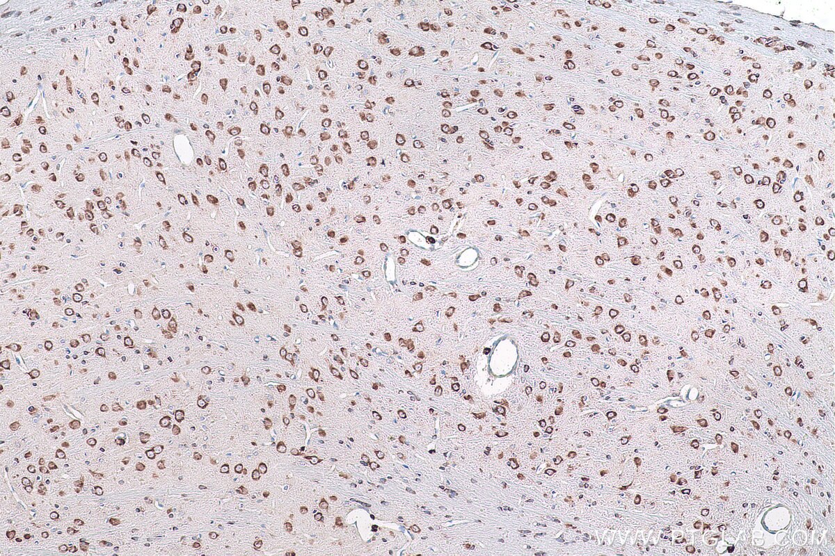 IHC staining of rat brain using 16500-1-AP