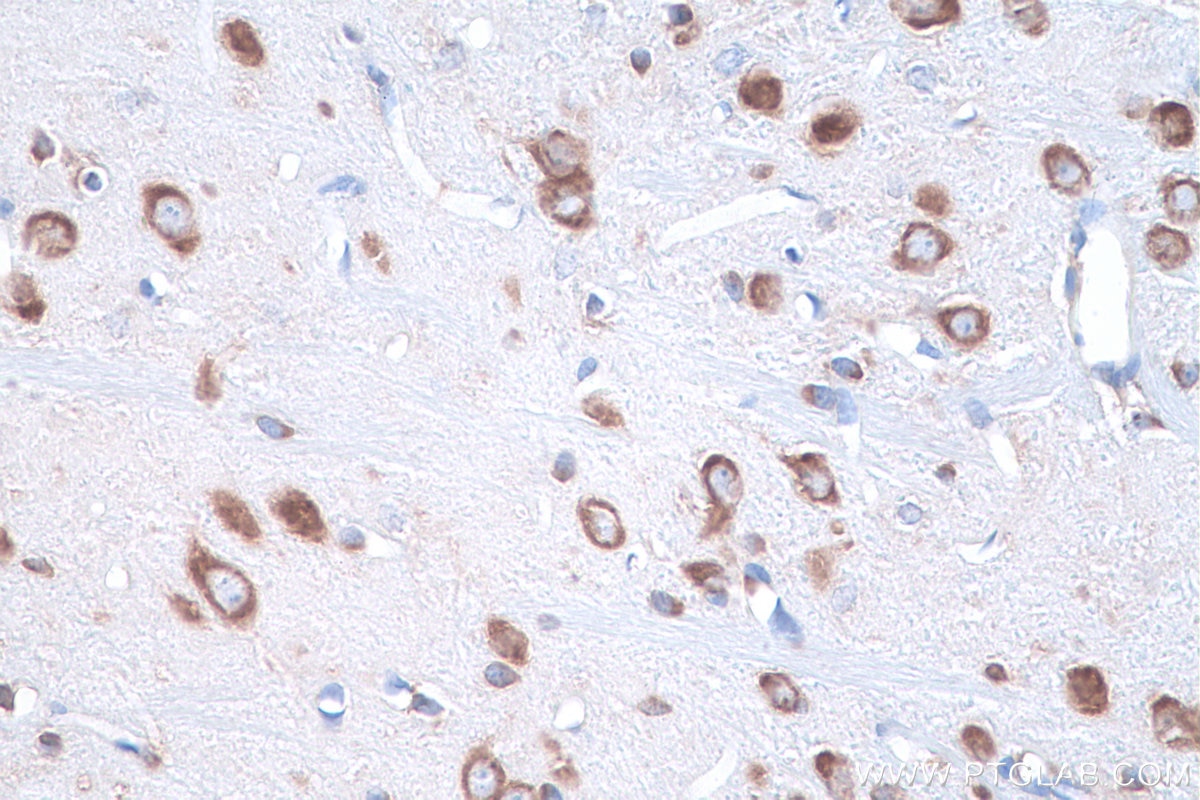 Immunohistochemistry (IHC) staining of rat brain tissue using BTF3L4 Polyclonal antibody (16500-1-AP)