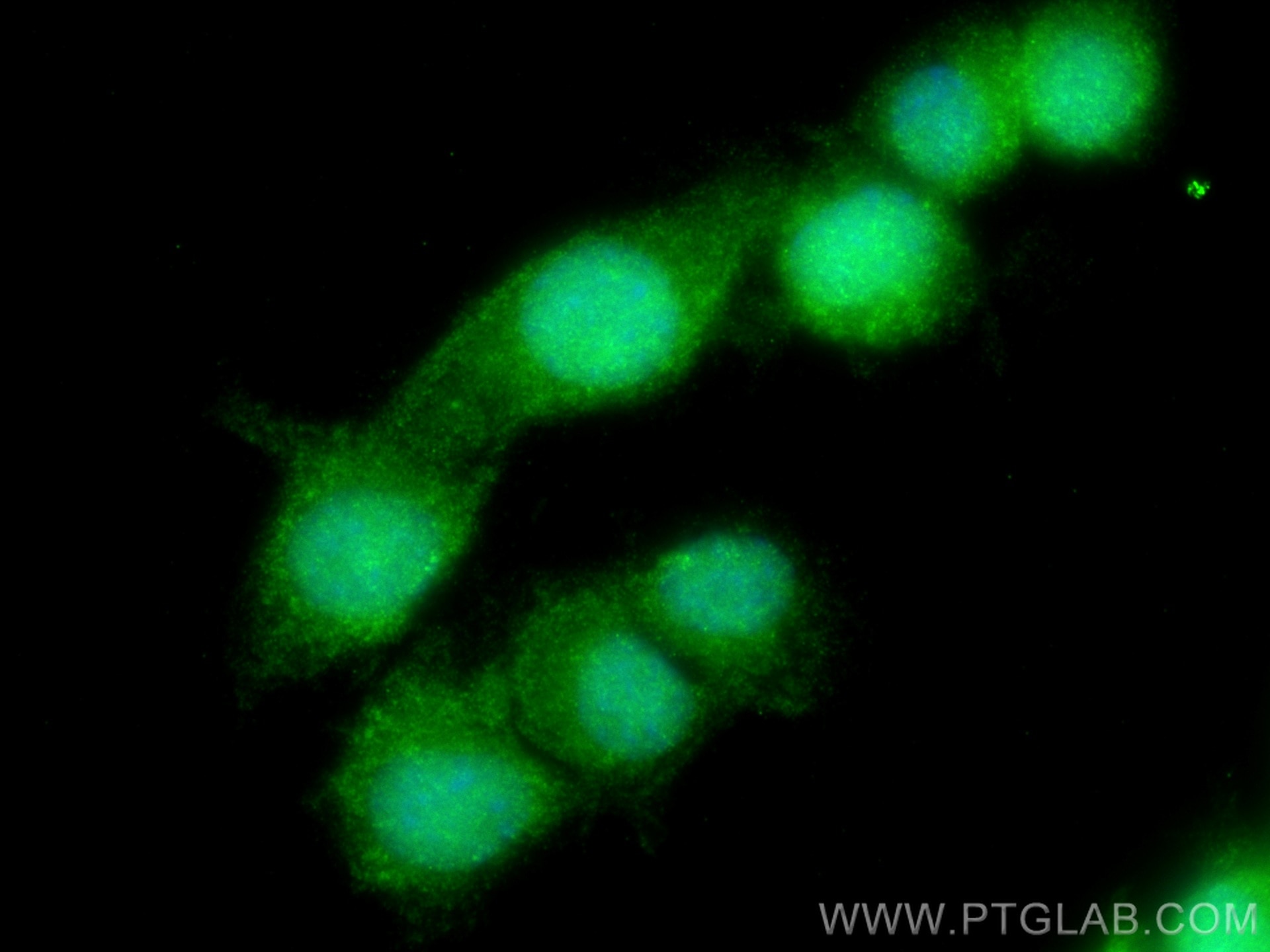 Immunofluorescence (IF) / fluorescent staining of Neuro-2a cells using BTG2 Polyclonal antibody (22339-1-AP)