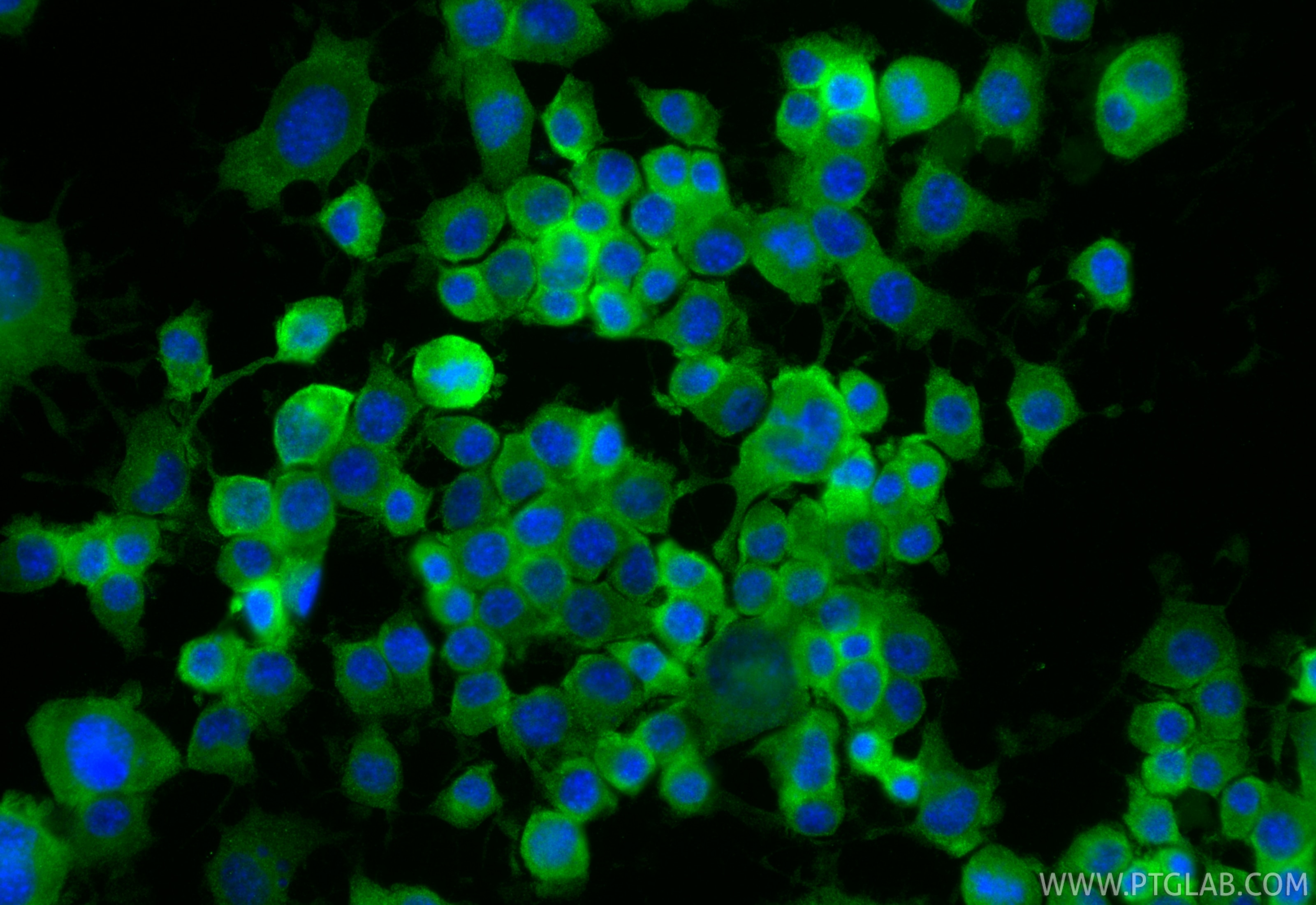 Immunofluorescence (IF) / fluorescent staining of Neuro-2a cells using BTG2 Polyclonal antibody (22339-1-AP)