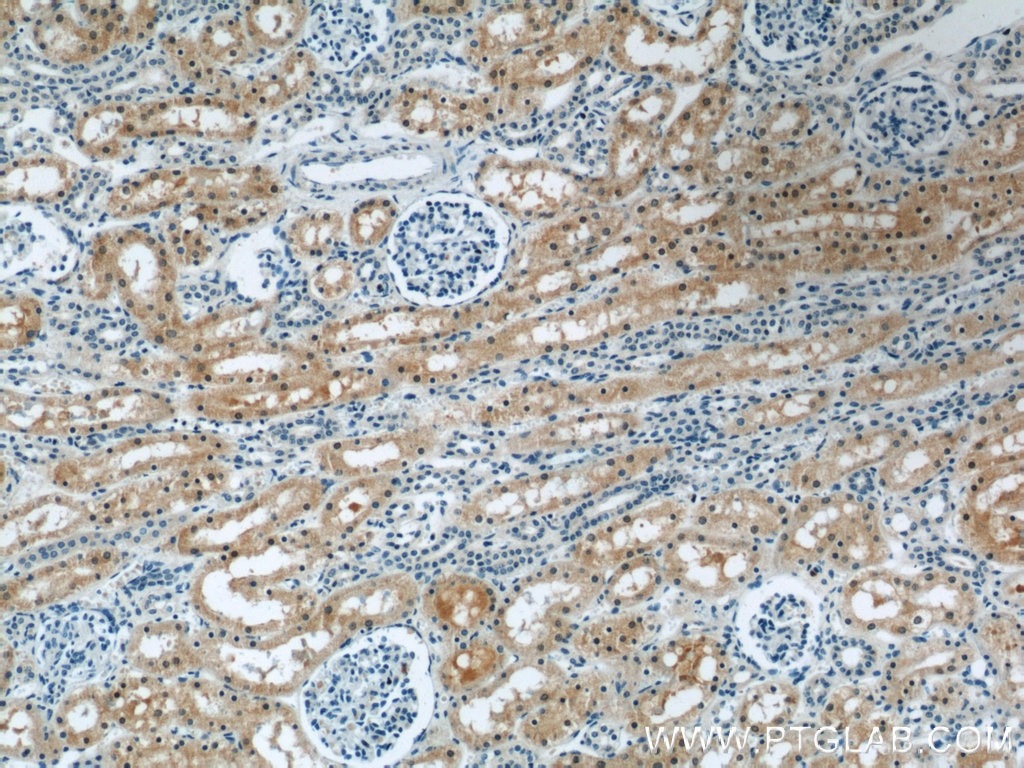 Immunohistochemistry (IHC) staining of human kidney tissue using BTG2 Polyclonal antibody (22339-1-AP)