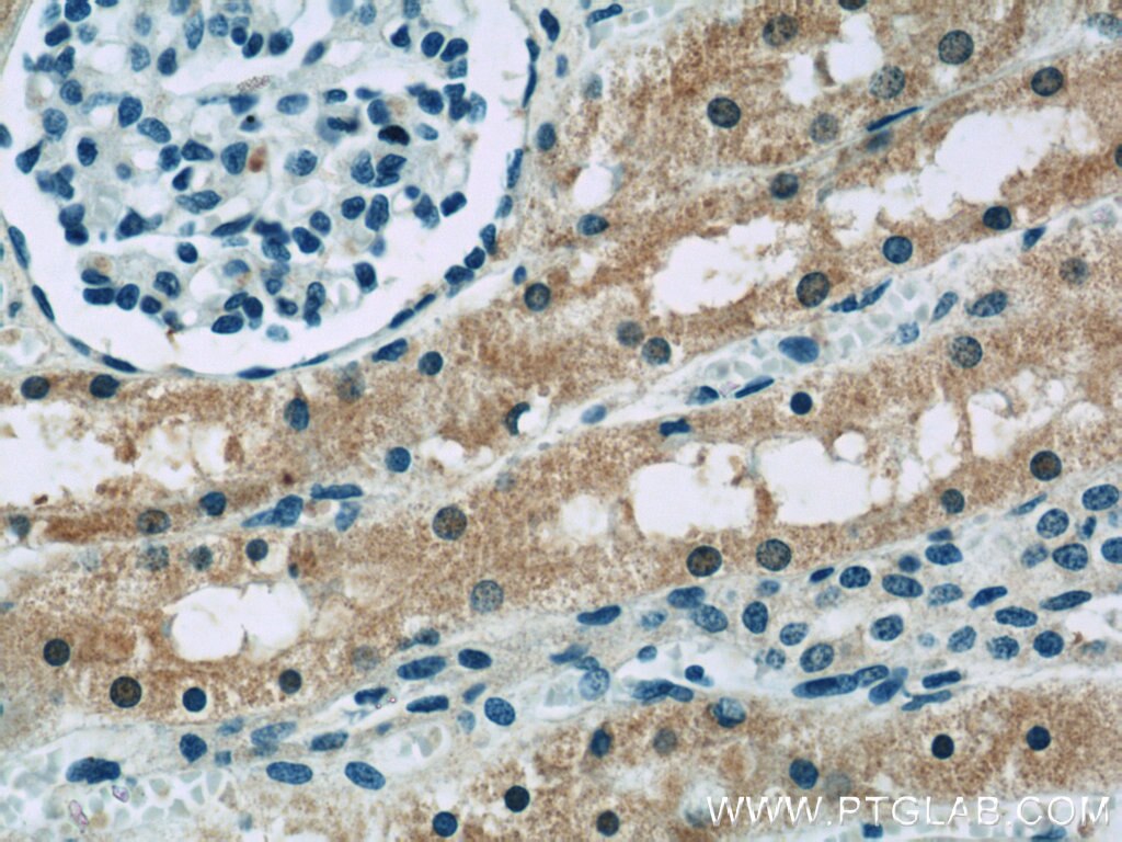 Immunohistochemistry (IHC) staining of human kidney tissue using BTG2 Polyclonal antibody (22339-1-AP)