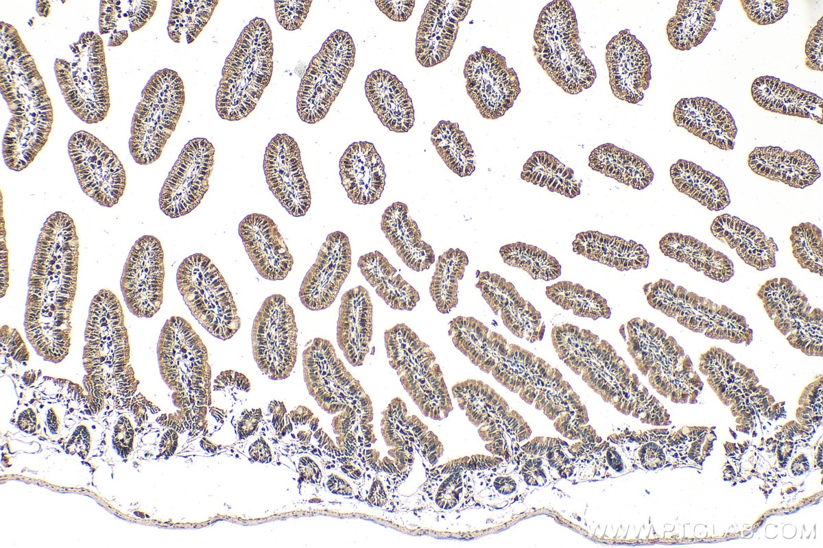 Immunohistochemistry (IHC) staining of mouse small intestine tissue using BTG2 Polyclonal antibody (22339-1-AP)