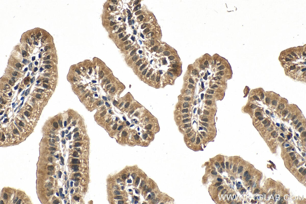 Immunohistochemistry (IHC) staining of mouse small intestine tissue using BTG2 Polyclonal antibody (22339-1-AP)