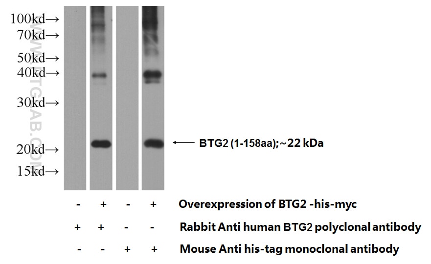 BTG2 Polyclonal antibody