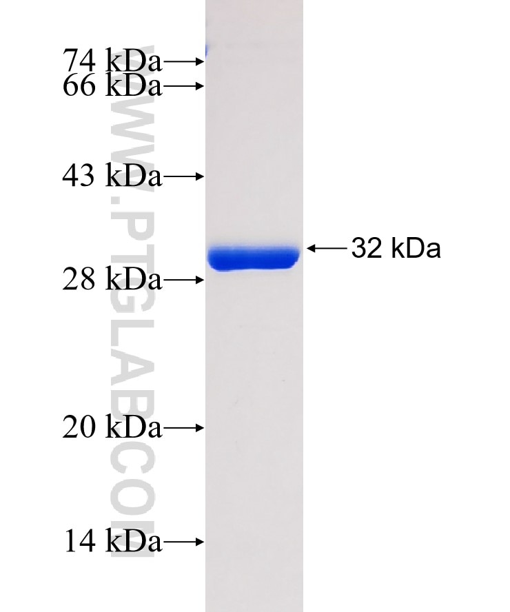 BTG2 fusion protein Ag17819 SDS-PAGE
