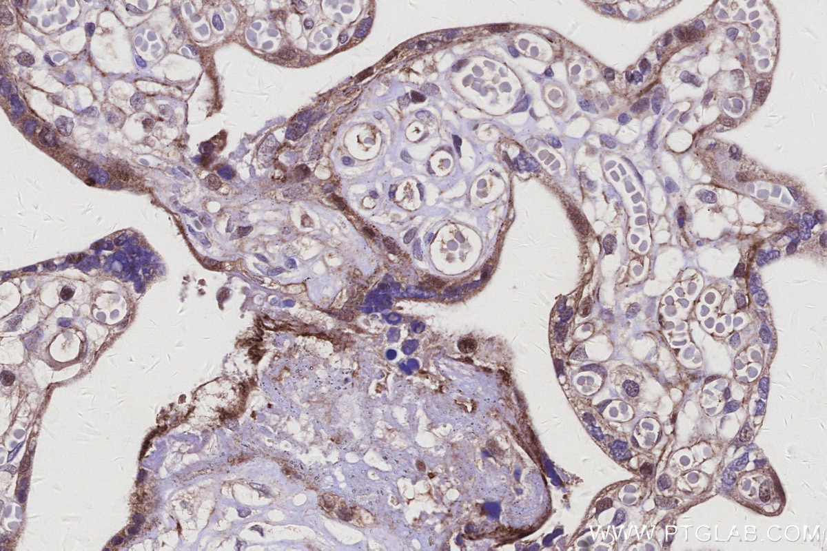 IHC staining of human placenta using 20336-1-AP Immunohistochemistry (IHC) staining of human placenta tissue using BTG3 Polyclonal antibody (20336-1-AP)