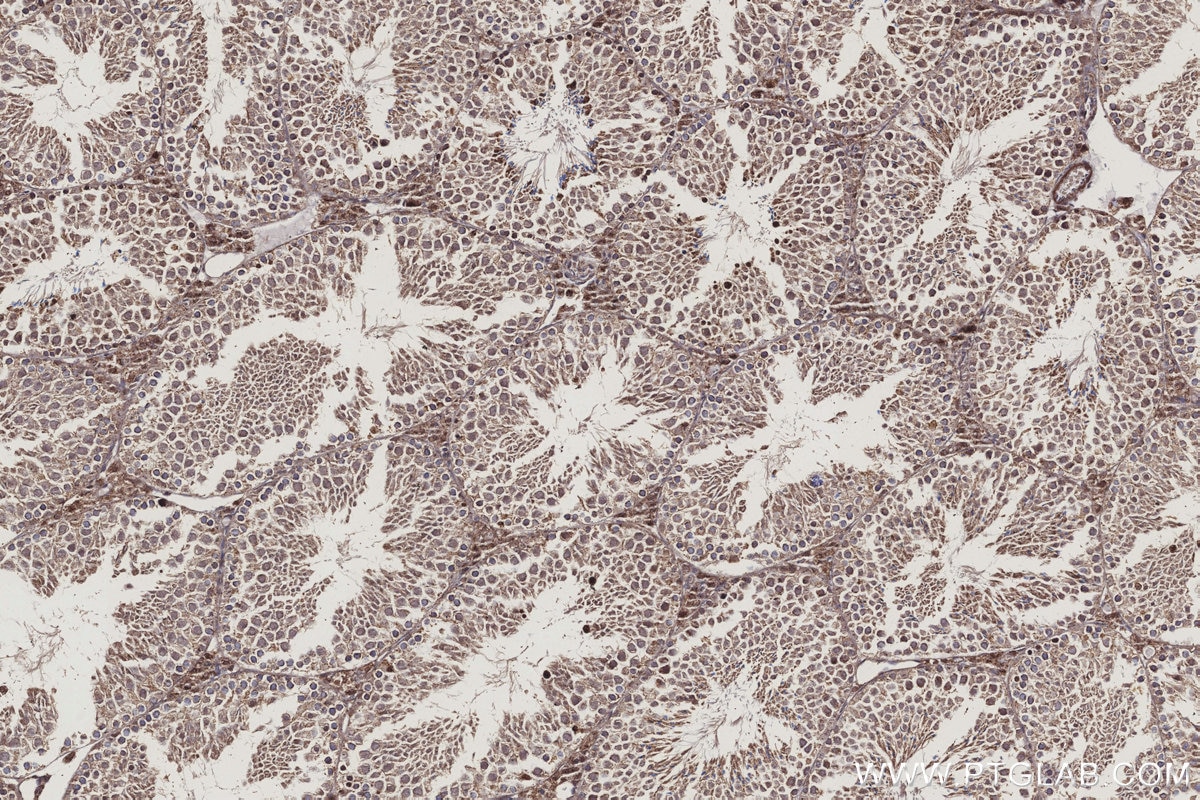 Immunohistochemistry (IHC) staining of mouse testis tissue using BTG4 Polyclonal antibody (20514-1-AP)
