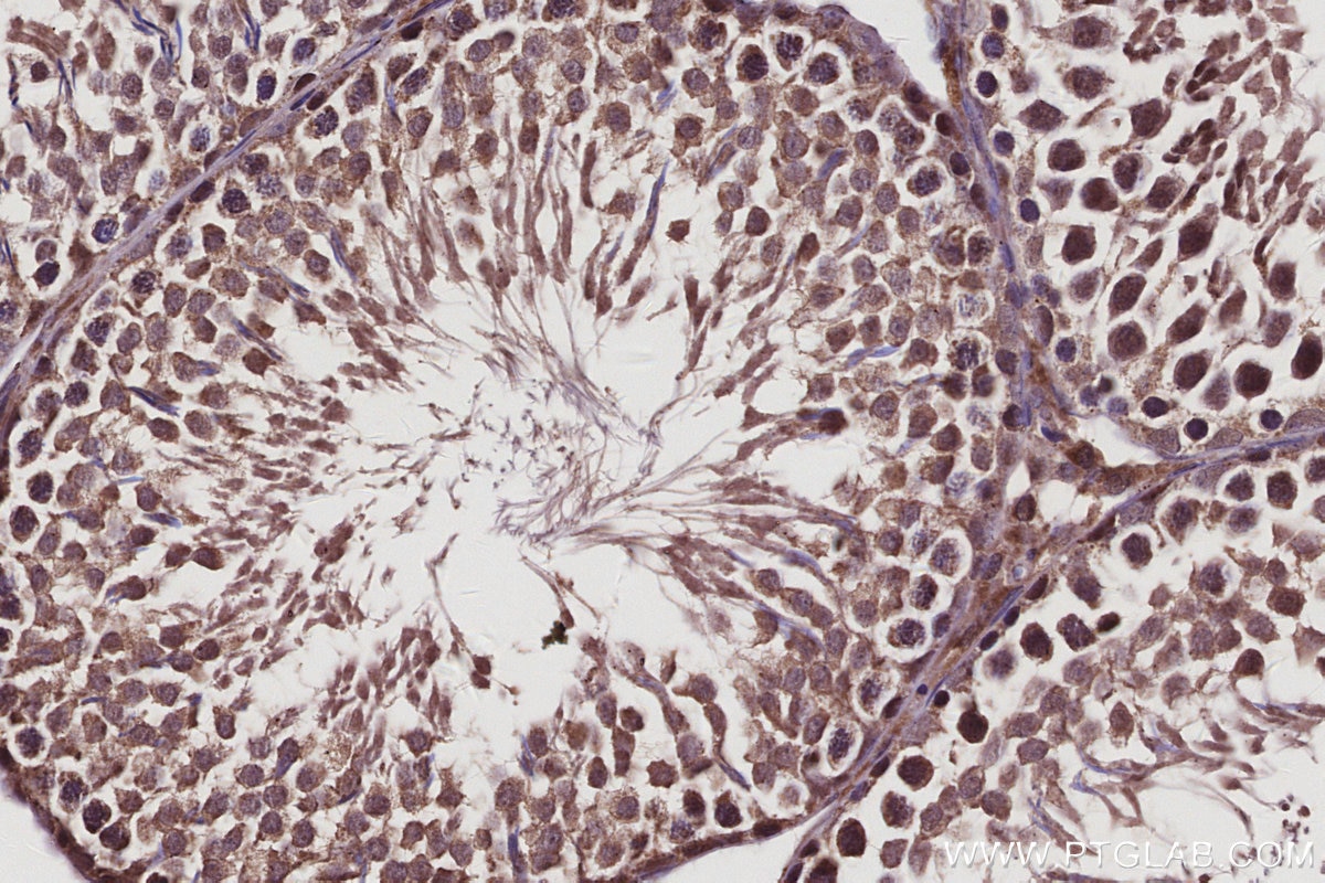 Immunohistochemistry (IHC) staining of rat testis tissue using BTG4 Polyclonal antibody (20514-1-AP)