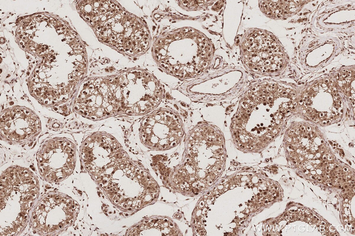 Immunohistochemistry (IHC) staining of human testis tissue using BTG4 Polyclonal antibody (20514-1-AP)