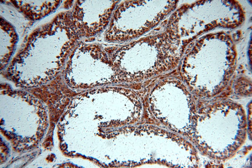 Immunohistochemistry (IHC) staining of human testis tissue using BTG4 Polyclonal antibody (20514-1-AP)