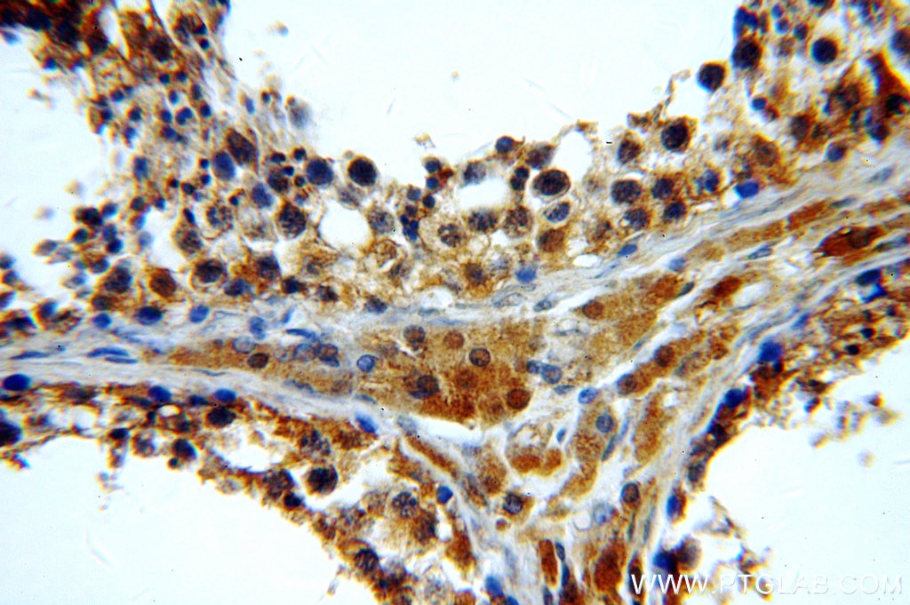 Immunohistochemistry (IHC) staining of human testis tissue using BTG4 Polyclonal antibody (20514-1-AP)
