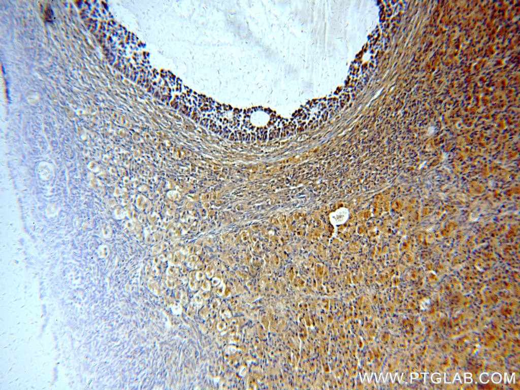 IHC staining of human ovary using 20514-1-AP