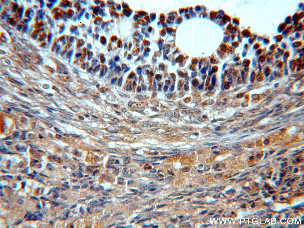 Immunohistochemistry (IHC) staining of human ovary tissue using BTG4 Polyclonal antibody (20514-1-AP)