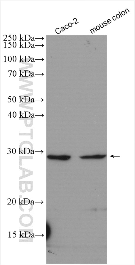 Western Blot (WB) analysis of various lysates using BTG4 Polyclonal antibody (20514-1-AP)
