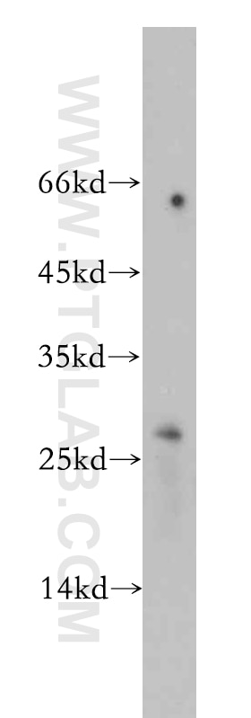Western Blot (WB) analysis of HeLa cells using BTG4 Polyclonal antibody (20514-1-AP)