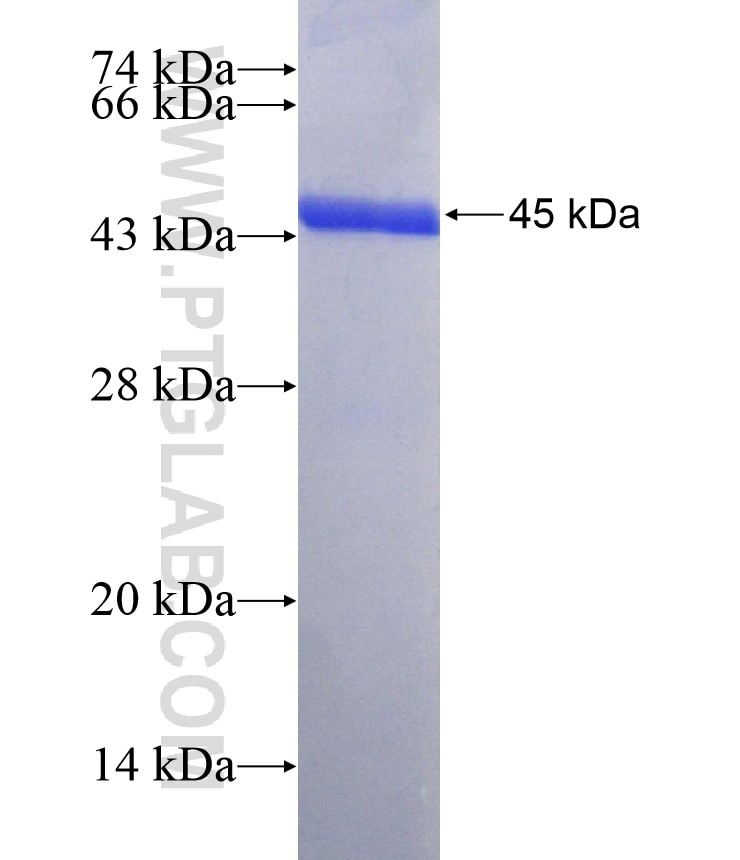 BTG4 fusion protein Ag14339 SDS-PAGE